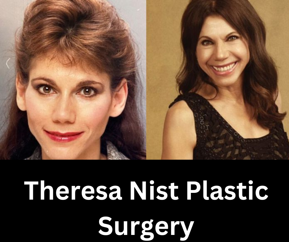 Theresa Nist Plastic Surgery Analyzing the Transformation of a