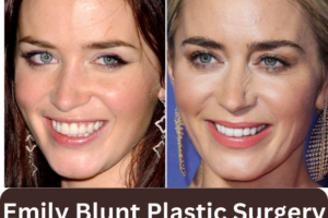 Emily Blunt Plastic Surgery