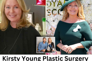 Kirsty Young Plastic Surgery