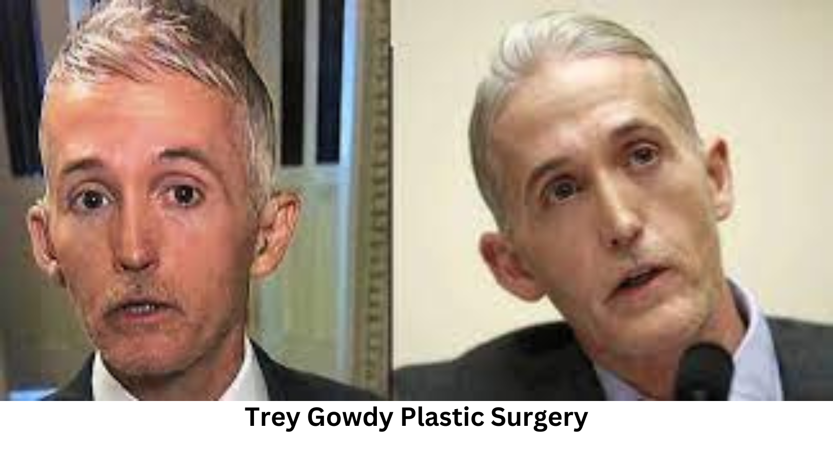 Trey Gowdy Plastic Surgery: Unveiling the Truth Behind the Rumors ...