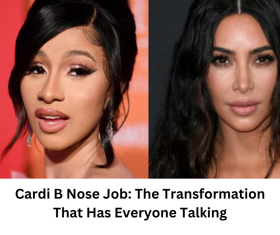 Cardi B Nose Job: The Transformation That Has Everyone Talking ...