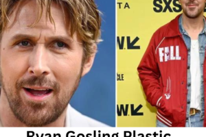Ryan Gosling Plastic Surgery