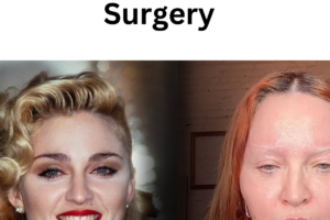 Madaonna Plastic Surgery