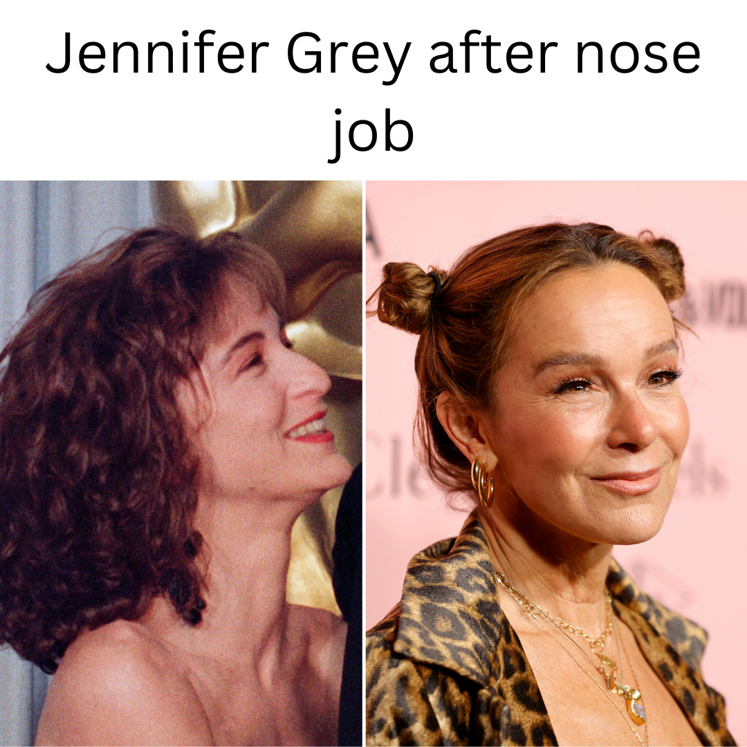 Jennifer Grey after nose job -Impact of Plastic Surgery - Celebrity ...