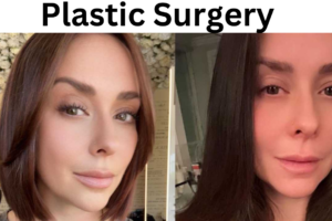 Jennifer Love Hewitt Plastic Surgery