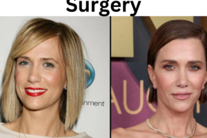 Kristen Wiig Plastic Surgery
