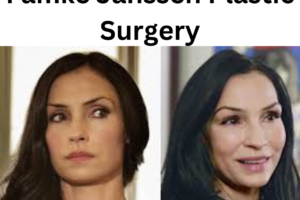 Famke Janssen Plastic Surgery