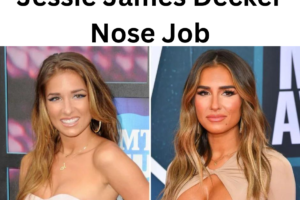 Jessie James Decker Nose Job