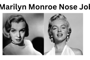 Marilyn Monoroe Nose Job