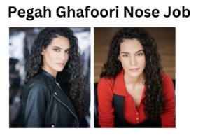 Pegah Ghafoori Nose Job