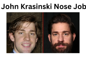 John Krasinski Nose Job