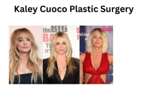 Kaley Cuoco Plastic Surgery