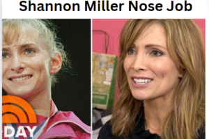 shannon miller nose job