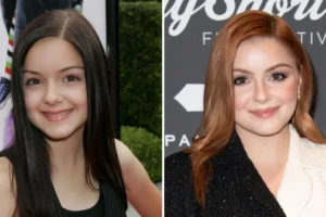 ariel winter nose job