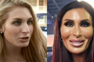 Laura Loomer Plastic Surgery