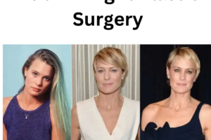 Robin Wright Plastic Surgery