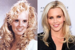 Jenny McCarthy Plastic Surgery