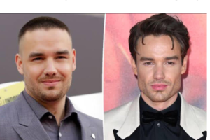 liam payne plastic surgery