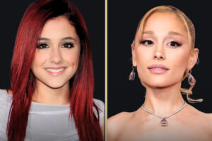 Ariana Grande Plastic Surgery