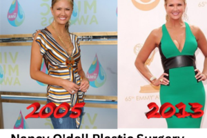 nancy o'dell plastic surgery