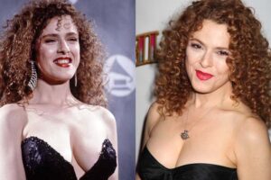 bernadette peters plastic surgery